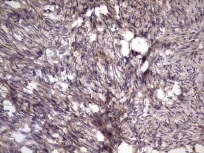 Immunohistochemistry: phakinin Antibody (OTI4E7) [NBP2-46573]