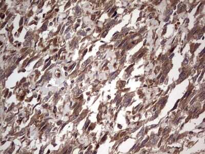 Immunohistochemistry: phakinin Antibody (OTI4E7) [NBP2-46573]