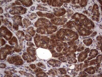 Immunohistochemistry: phakinin Antibody (OTI4E7) [NBP2-46573]