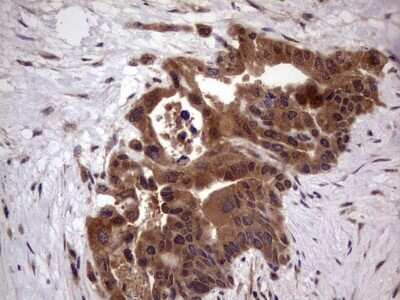 Immunohistochemistry: phakinin Antibody (OTI4E7) [NBP2-46573]