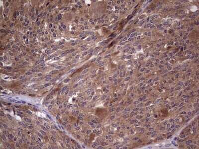 Immunohistochemistry: phakinin Antibody (OTI4E7) [NBP2-46573]