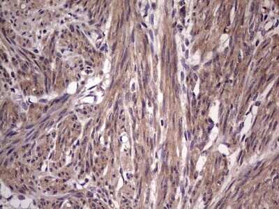 Immunohistochemistry: phakinin Antibody (OTI4E7) [NBP2-46573]