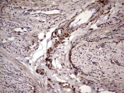 Immunohistochemistry: phakinin Antibody (OTI4E7) [NBP2-46573]