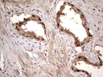 Immunohistochemistry: phakinin Antibody (OTI4E7) [NBP2-46573]