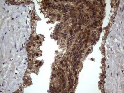 Immunohistochemistry: phakinin Antibody (OTI4E7) [NBP2-46573]