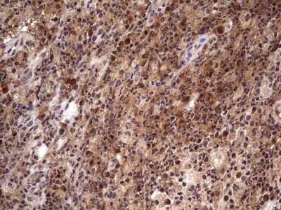 Immunohistochemistry: phakinin Antibody (OTI4E7) [NBP2-46573]