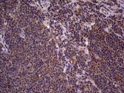 Immunohistochemistry: phakinin Antibody (OTI4E7) [NBP2-46573]
