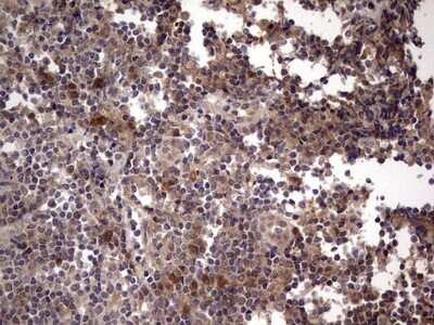 Immunohistochemistry: phakinin Antibody (OTI4E7) [NBP2-46573]