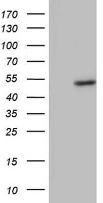 Western Blot: phakinin Antibody (OTI4E7) [NBP2-46573]