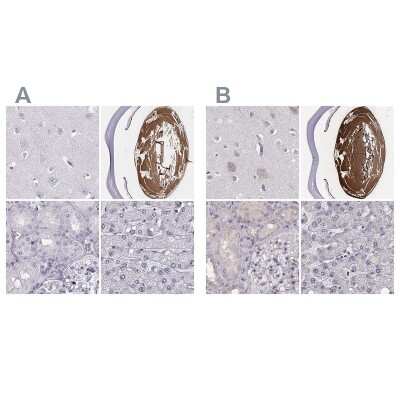 Immunohistochemistry-Paraffin: phakinin Antibody [NBP1-90621]