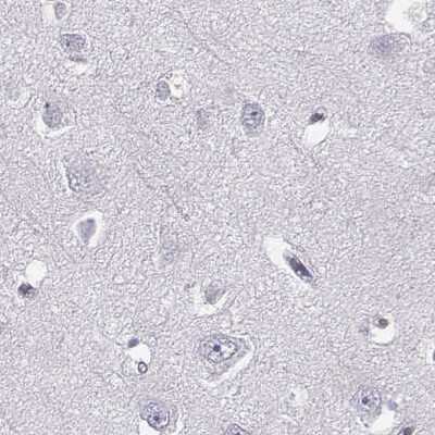 Immunohistochemistry-Paraffin: phakinin Antibody [NBP1-90621]