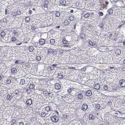 Immunohistochemistry-Paraffin: phakinin Antibody [NBP1-90621]