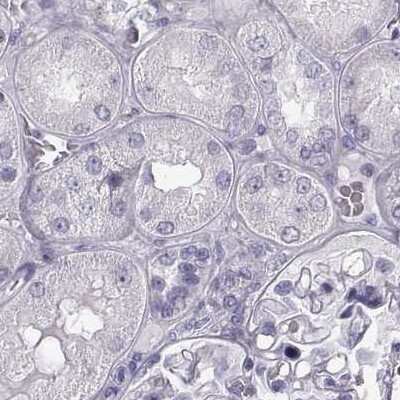 Immunohistochemistry-Paraffin: phakinin Antibody [NBP1-90621]