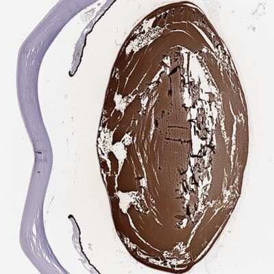 Immunohistochemistry-Paraffin: phakinin Antibody [NBP2-57096]