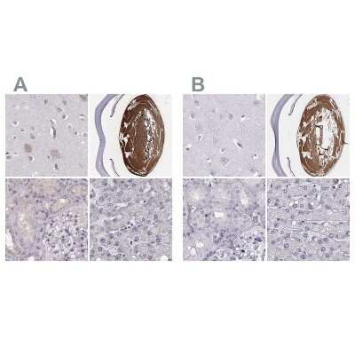 Immunohistochemistry-Paraffin: phakinin Antibody [NBP2-57096]