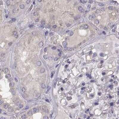 Immunohistochemistry-Paraffin: phakinin Antibody [NBP2-57096]
