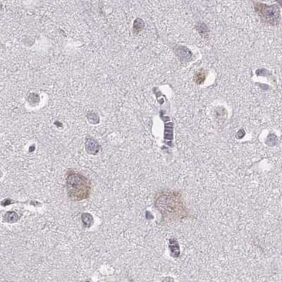 Immunohistochemistry-Paraffin: phakinin Antibody [NBP2-57096]