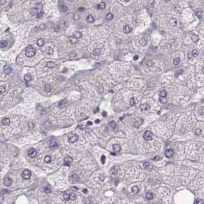 Immunohistochemistry-Paraffin: phakinin Antibody [NBP2-57096]