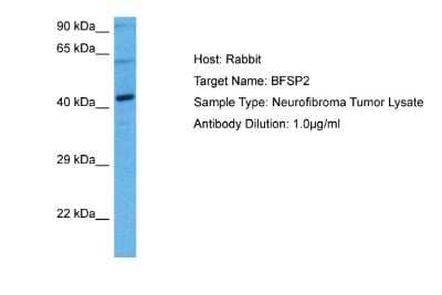 Western Blot: phakinin Antibody [NBP2-88042]