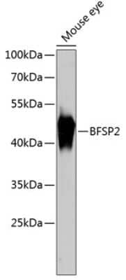 Western Blot: phakinin AntibodyAzide and BSA Free [NBP2-94248]