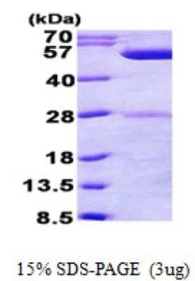 SDS-PAGE: Recombinant E. coli phrB His Protein [NBP2-22657]