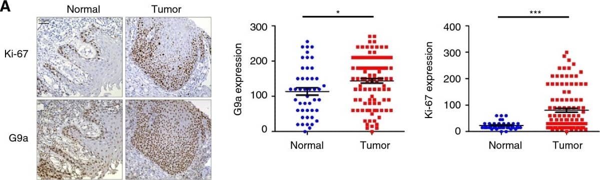 Detection of Human G9a/EHMT2 by Immunohistochemistry