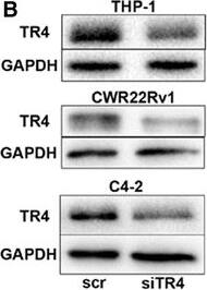 Detection of Human TR4/NR2C2 by Western Blot