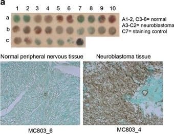 Detection of Human TLX/NR2E1 by Immunohistochemistry