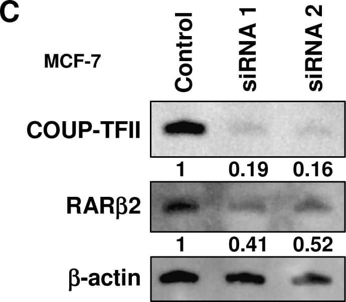 Detection of Human COUP-TF II/NR2F2 by Knockdown Validated