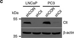 Detection of Human COUP-TF II/NR2F2 by Knockdown Validated