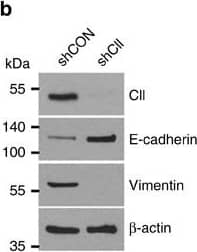 Detection of Human COUP-TF II/NR2F2 by Knockdown Validated