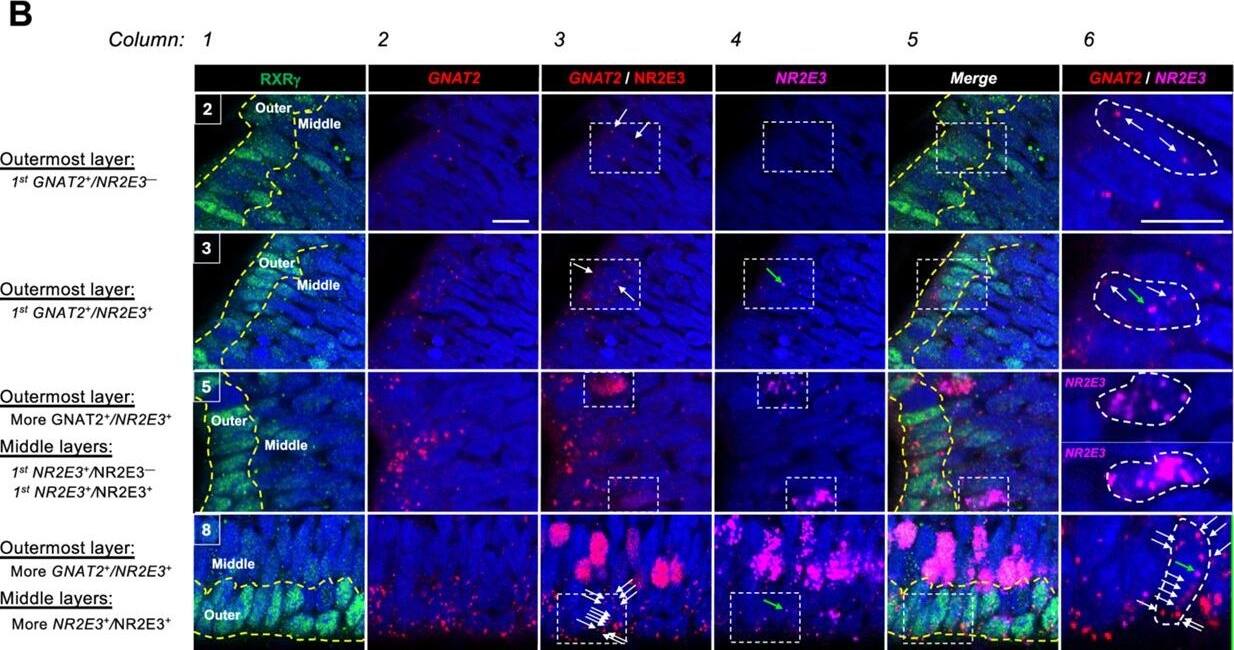 Detection of PNR/NR2E3 by Immunohistochemistry