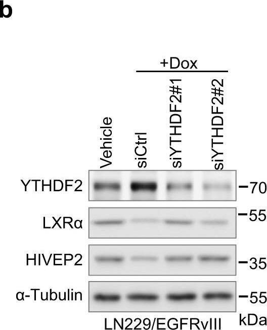 Detection of LXR alpha/NR1H3 by Western Blot