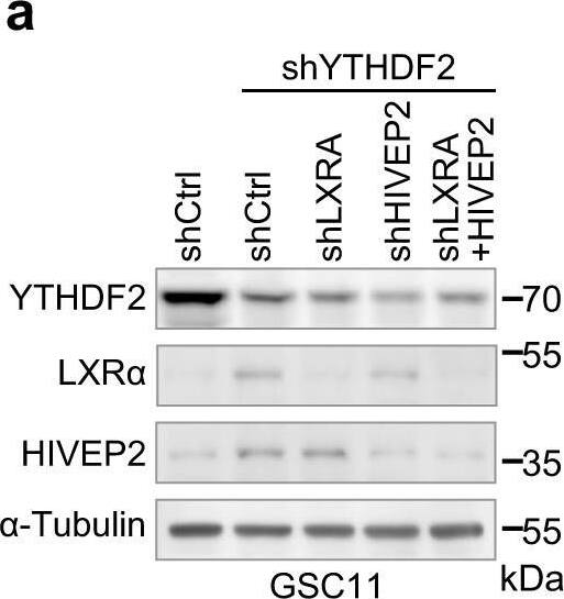 Detection of LXR alpha/NR1H3 by Western Blot