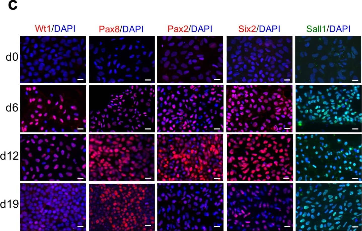 Detection of Human SALL1 by Immunocytochemistry/Immunofluorescence