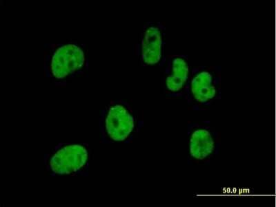 Immunocytochemistry/ Immunofluorescence: pre-mRNA cleavage factor I (59 kDa subunit) Antibody [H00079869-B01P]