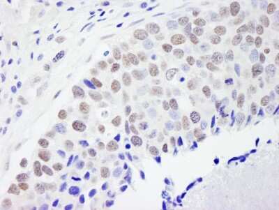 Immunohistochemistry: pre-mRNA cleavage factor I (59 kDa subunit) Antibody [NB100-61600]