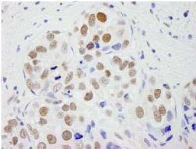 Immunohistochemistry-Paraffin: pre-mRNA cleavage factor I (59 kDa subunit) Antibody [NB100-61600]