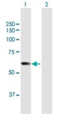 Western Blot: pre-mRNA cleavage factor I (59 kDa subunit) Antibody [H00079869-B01P]