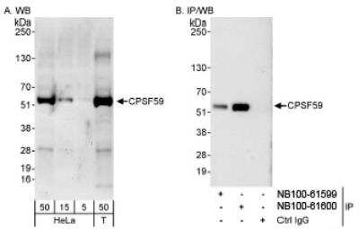 Western Blot: pre-mRNA cleavage factor I (59 kDa subunit) Antibody [NB100-61599]