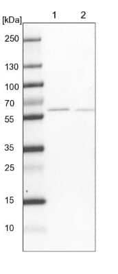 Western Blot: pre-mRNA cleavage factor I (59 kDa subunit) Antibody [NBP1-89868]