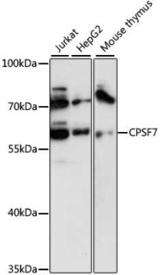 Western Blot: pre-mRNA cleavage factor I (59 kDa subunit) AntibodyAzide and BSA Free [NBP2-94718]