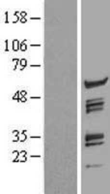 Western Blot: pre-mRNA cleavage factor I (59 kDa subunit) Overexpression Lysate [NBL1-10752]