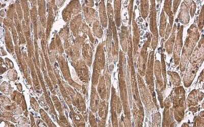 Immunohistochemistry-Paraffin: preproANP Antibody [NBP2-14872]