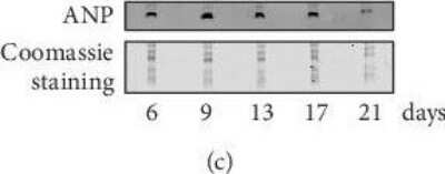 Western Blot: preproANP Antibody [NBP2-14872]