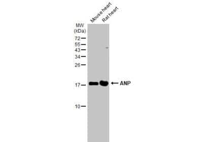 Western Blot: preproANP Antibody [NBP2-14873]