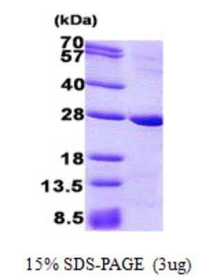 SDS-PAGE: Recombinant Human PrPC His Protein [NBP2-23360]