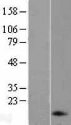 Western Blot: preproANP Overexpression Lysate [NBL1-13752]