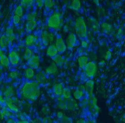 Immunocytochemistry/ Immunofluorescence: proBDNF Antibody - Azide and BSA Free [NB100-98756]