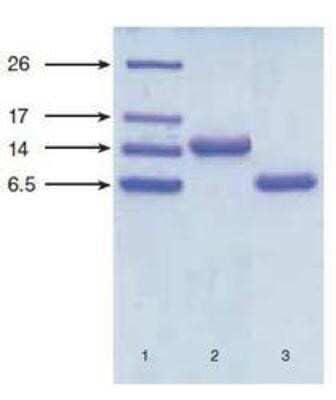 Western Blot: NT-proBNP Antibody (11D1cc) [NB120-13059]